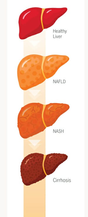 Liver Infographic
